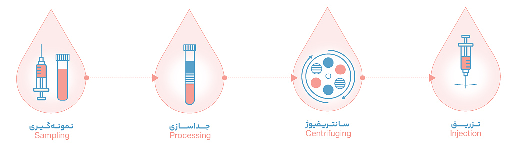 رودمپ فرآیند سلول درمانی با کیت پی آر پی