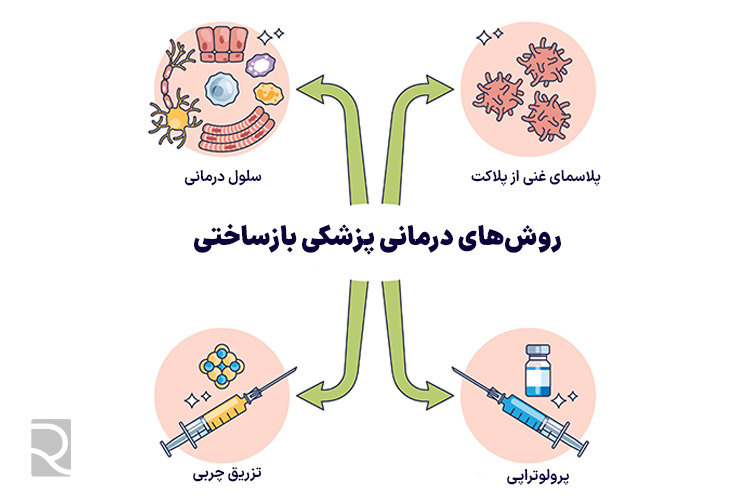 روش درمان پزشکی بازساختی